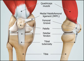 Tibial Tubercle Osteotomy